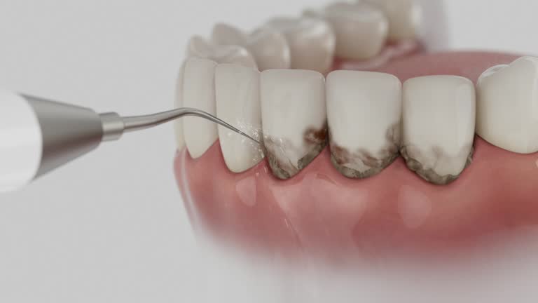 Reliable Tooth Extraction contractor in Estancia, NM by Smile Center Dentistry